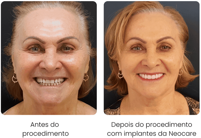 caso-2